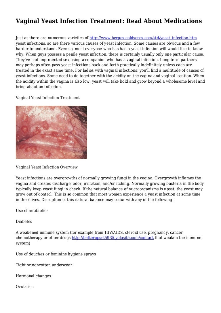 Vaginal yeast infection advice treatment blog pics 13